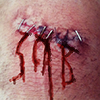 7 Shocking Facts About Scabs – By @CiRCUStrongman